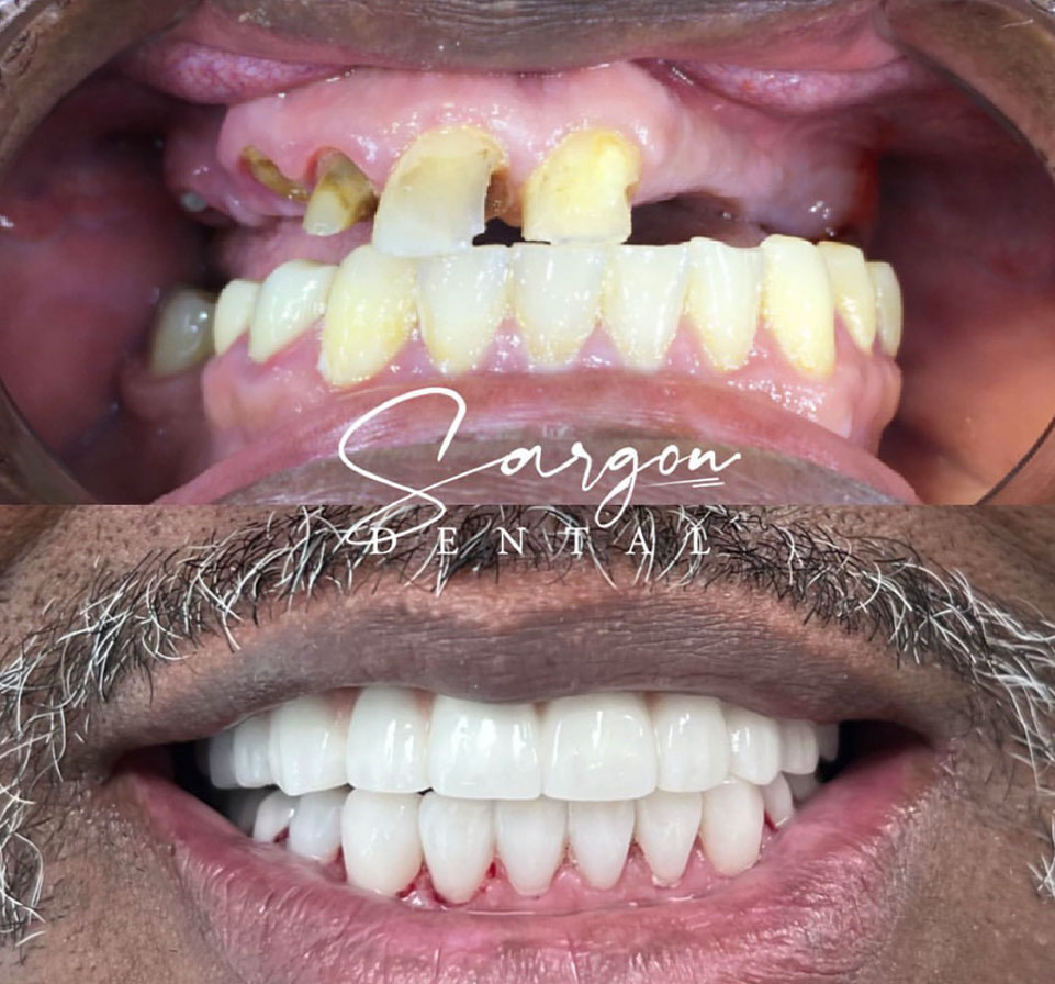 Patient transformation