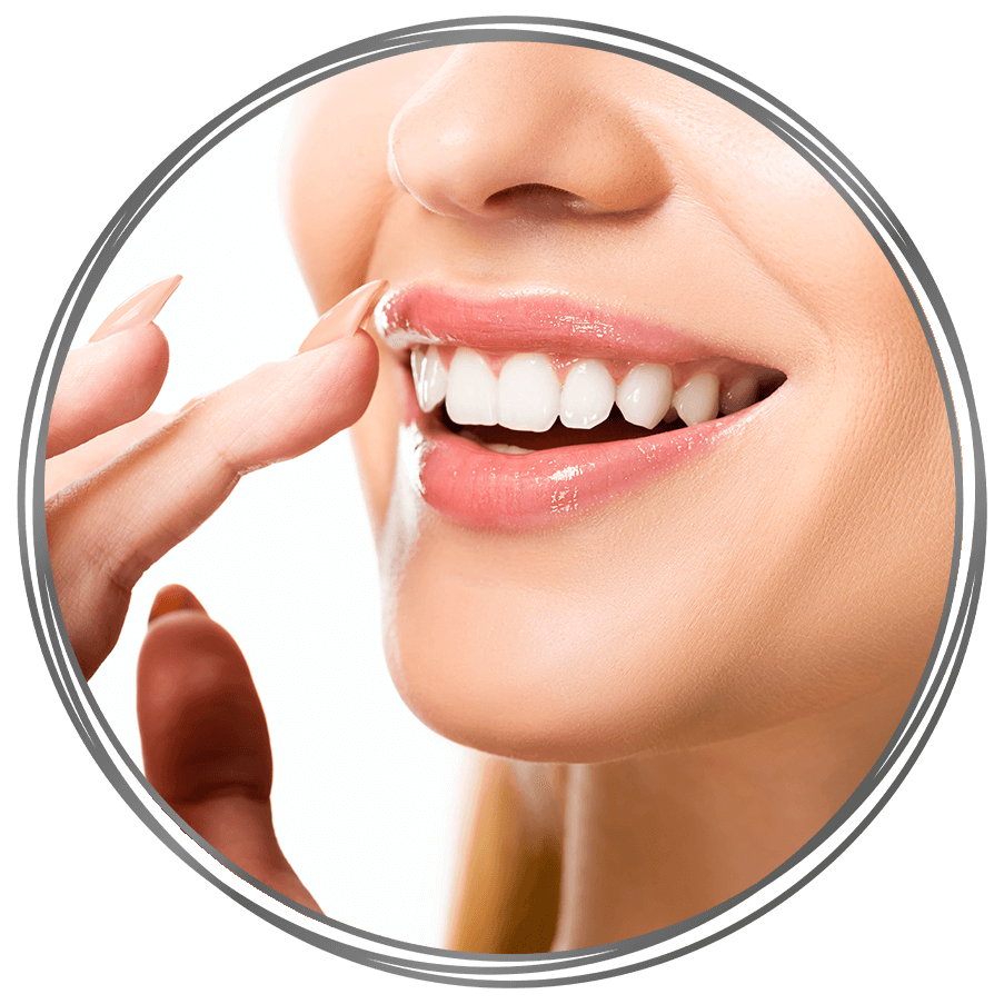 Diamoneers™ Veneers