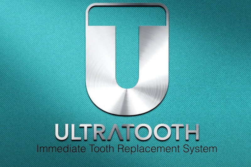 Step-by-Step Ultratooth Placement